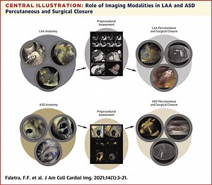 Imaging for Patient’s Selection and Guidance of LAA and ASD Percutaneous and Surgical Closure:
