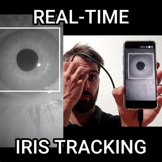 Smartphone Iris Tracking is Getting Scary Accurate 🤯 #ComputerVision