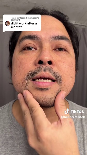 10 Days of Castor Oil on Beard: Before and After Results