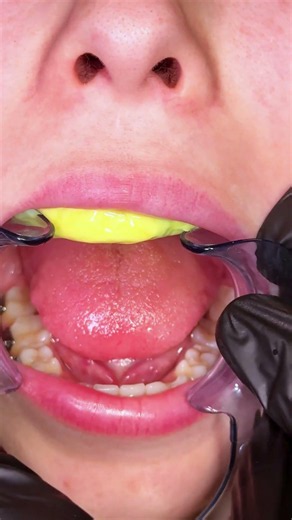 CLEANING FROM YELLOW AND GREEN CANDY