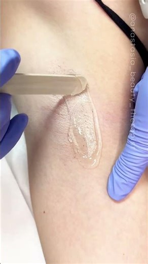 Demonstration of waxing extra short hair with Starsoft hard wax from Starpil