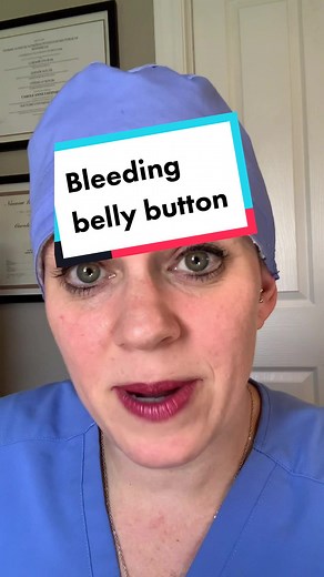 Umbilical Cord Stump Falling Off - What to Do If Belly Button is Bleeding