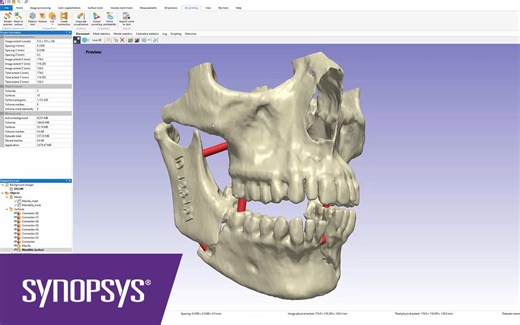 【Simpleware】3D打印工具包