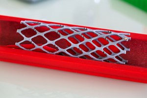 Study questions whether stents relieve chest pain