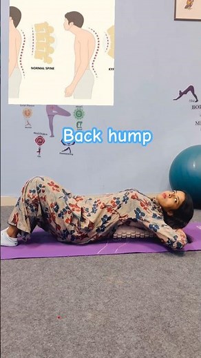 Back hump exercise 1best exercises #physiotherapist #backpainrehab #doctor #physiotherapist