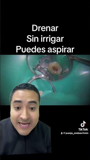 Drenaje de absceso apical agudo