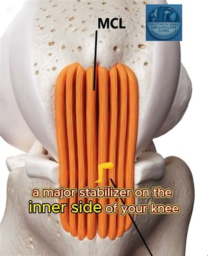 The Medial Collateral Ligament or the MCL