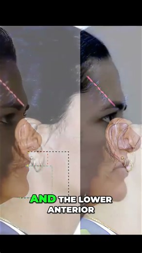 Jaw-Dropping Facial Transformation: Before & After Reveal! #shorts