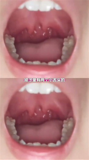 人类的异形图鉴 #万万没想到 #年年有娱