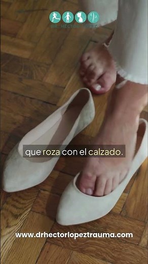 👣 ¿Juanete o dedo en martillo? Aprende a diferenciarlos 🦶
