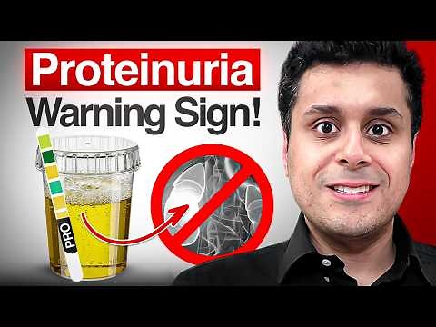 Protein in Urine? New Treatments & Tests You Must Know (Doctor Explains)