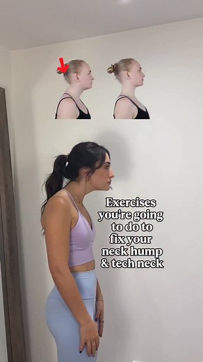 Comment “MORE INFO” & I’ll send you the link to my posture programs! 💖💖 #poorposture #backpain #posture #posturecorrection #backpainrelief #roundedshoulders #neckhump #postureexercises #neckpain #shoulderpain | Rachel Pantano