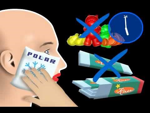 What is Jaw Joint Effusion