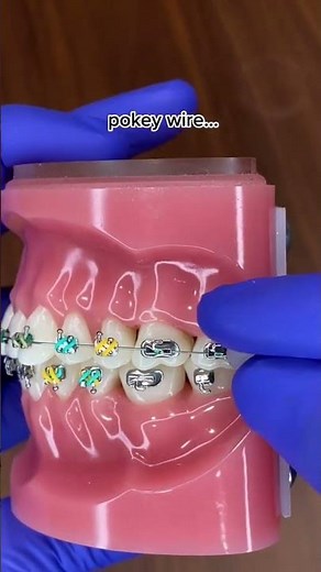 Orthodontic wax usage steps