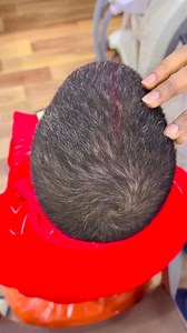 Call - 8076824433 #cancerdemama #oncology #cancerresearch #cancertreatment #c #dankmemes #tarot #chemo | Nisha Lambha - Sparsh Beauty Care & Hair Treatment LLP