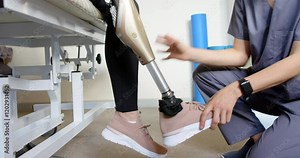 Adjusting prosthetic leg, healthcare professional assisting patient with fitting in clinic Stock Video