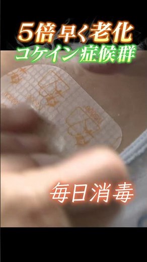 【５倍早く老化が進む】寿命短いので…「コケイン症候群」 今を楽しむ母子の笑顔 part2 #コケイン症候群# #abcテレビ# #news