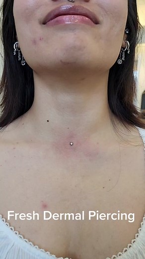 Fresh neck dermal with 3mm bezel. DM if you have any questions. I'll be off until Tuesday 😊 . . . #piercingaddict #piercings #neckdermal #dermal #surfacepiercing #piercingsnearme #piercernearme #orangepiercings #orangepiercer #professionalpiercer #orange