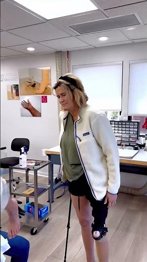 Rotationplasty| Gets Silicone Prosthetic Cover