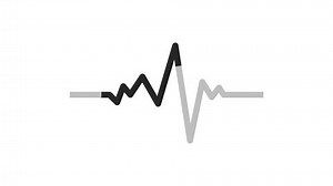 Heart Rhythm Black White Loading Animation: стоковое видео (без лицензионных платежей), 1109279277 | Shutterstock