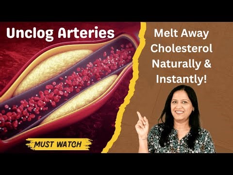 6 Most Effective Home Remedies to Lower Cholesterol Naturally (Backed by Science!)