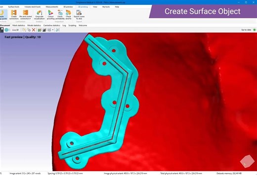 【Simpleware】V-2024.06 截骨导板设计工具