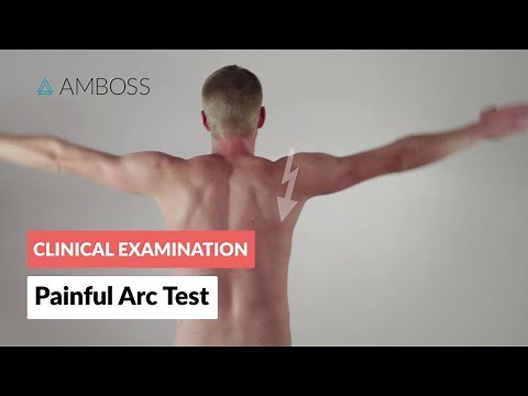 Impingement Syndrome - Painful Arc Test - Clinical Examination