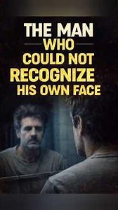 He Could Not Recognise His Own Face | Science Reveals Shocking Reason #brainmystery #strangebuttrue