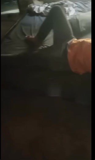 Frontal Lobe Epilepsy – “Fencer Posture” اس ویڈیو میں نظر آنے والی باڈی پوزیشن کو Fencer Posture کہا جاتا ہے، جو عموماً Frontal lobe epilepsy خصوصاً Supplementary Motor Area (SMA) seizures میں دیکھی جاتی ہے۔ 🧠 یہ پوزیشن کیسی ہوتی ہے؟ • ایک بازو سیدھا آگے کی طرف تن جاتا ہے • دوسرا بازو مُڑ جاتا ہے • سر اکثر سیدھے بازو کی طرف مُڑ جاتا ہے یہ شکل بالکل تلوار بازی (fencing) والی پوزیشن جیسی لگتی ہے، اسی لیے اسے یہ نام دیا گیا ہے۔ ⚡ یہ کس چیز کی نشانی ہے؟ یہ focal seizure کی علامت ہے جو دماغ کے فرنٹل