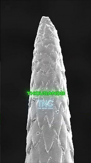 #The danger of A porcupine spike