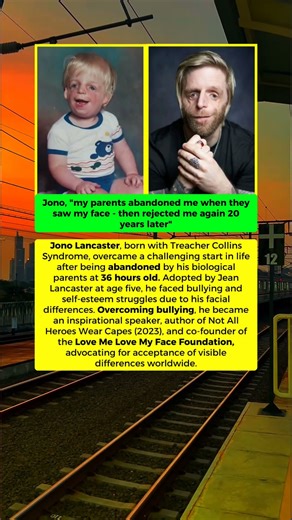 🥺❤️ Jono Lancaster really managed to turn his tragic story into success