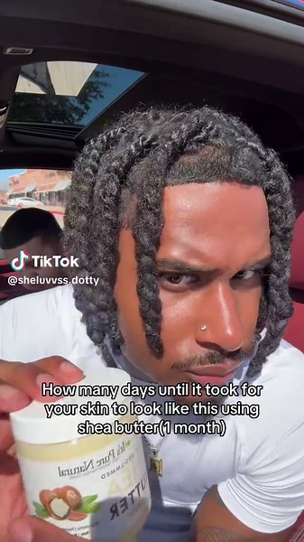 Transform Your Skin Naturally with Shea Butter in Just One Month