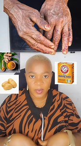 How to remove old hands, remove wrinkles hands and fingers. Get younger Hands really f@st #naturalremedies #NaturalBeauty #NaturalSkincare #natural | Editorial Beauty556