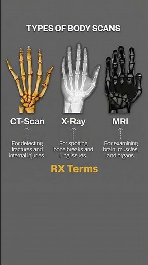 Types of Medical Scans Explained|X-Ray vs CT vs MRI 🔍#Shorts#YouTubeShorts #ViralShorts#Trending#FYP