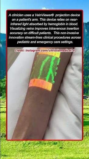 How Modern Vein Finder Technology Illuminates Subcutaneous Blood Vessels