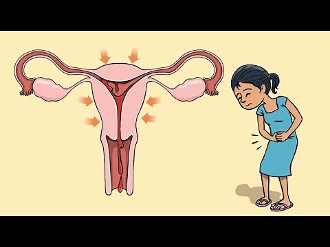 What are period cramps and how to deal with them?