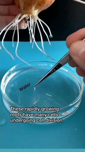 Seeing Chromosome Under the Microscope