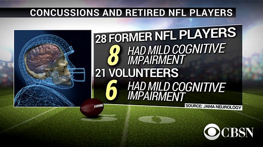 A report in the JAMA Neurology monthly suggests a connection between concussions on the football field and memory impairment later in life