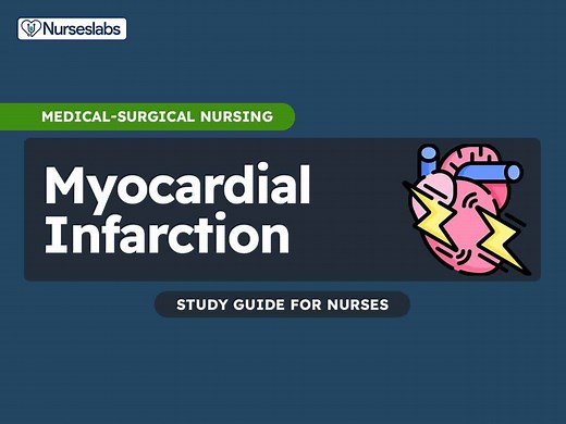 Myocardial Infarction