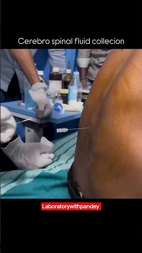 cerebrospinal fluid (CSF) collection-a vital procedure done