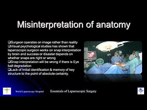 Master Class of Mistakes and Errors in Minimal Access Surgery • Video • MEDtube.net