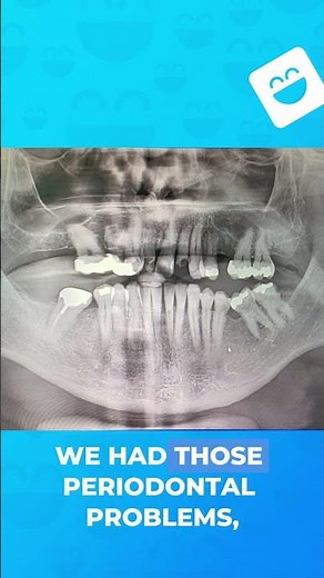 🔄 From Complex Bite Problems to a Functional, Beautiful Smile 🦷✨