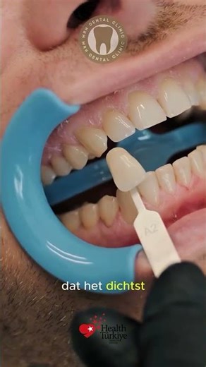 Zirkonium kronen behoren tot de meest gekozen oplossingen binnen de esthetische tandheelkunde da