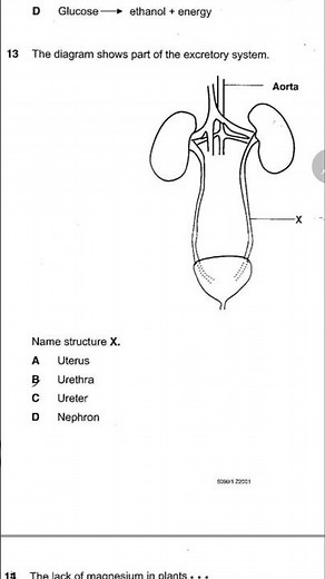 Excretory System #biology