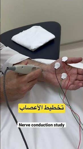 تخطيط الأعصاب nerve conduction study