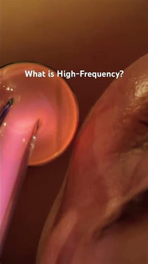 Skincare Tools: High-Frequency✨ #satisfying #skin #shortsvideo