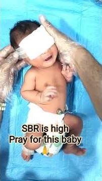 NNJ Baby Journey in Our NICU | Eye Pad Procedure for Phototherapy |Newborn Jaundice Care #baby#nicu