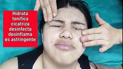 199K views · 5.1K reactions | Cómo depurar el Aloe vera y ACLARAR NATURALMENTE la piel, 4 recetas caseras para sacarle el mayor provecho a nuestra SÁBILA ó ÁLOE VERA, no tires la piel, ponla a secar porque haremos shampoo Solido 珞 | Kary Contigo | Facebook
