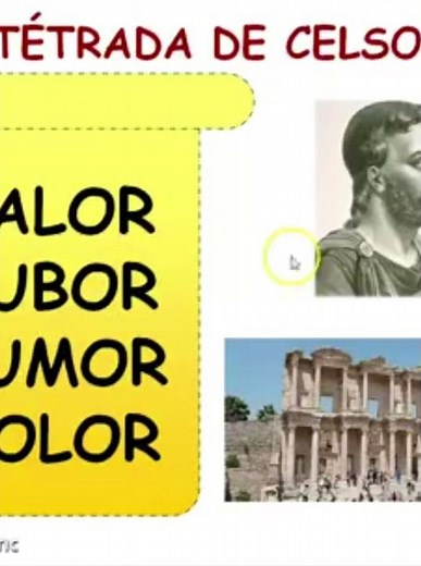 Tetrada de Celso • FISIOPATOLOGIA MÉDICA #FisiopatologiaMedica #FisiologiaMedica