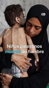 478K views · 17K reactions | El hambre se ensaña con los niños en Gaza Crece la presión internacional sobre Israel para que desbloquee la entrada de alimentos en la Franja de Gaza. Médicos Sin Fronteras informa que 1 de cada 4 niños de entre seis meses y cinco años sufre algún grado de desnutrición, y que los casos graves se han triplicado en solo dos semanas. | DW Español | Facebook
